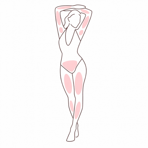 Full Bikini + Underarms + Full Legs (without knees and feet) + Arms (without hands)
Extended package for maximum coverage of major body areas.