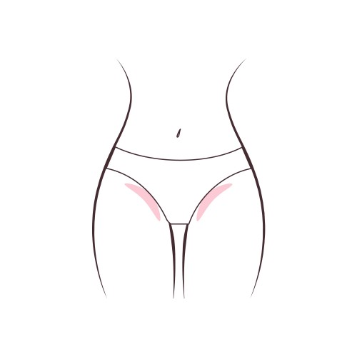 Along the panty line. Neat shaping along the edges of the underwear.