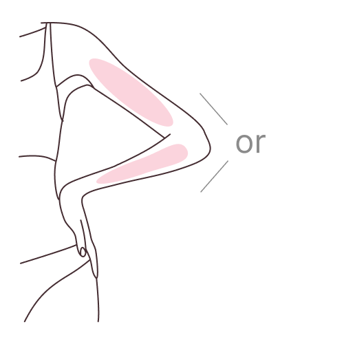 Forearms to elbows OR upper arms.
Hands and fingers are not included.