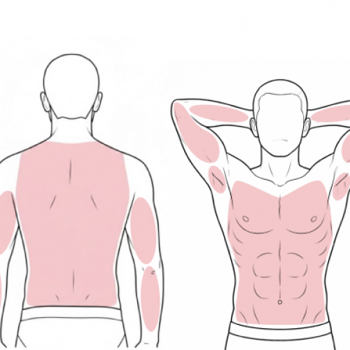 Back + Chest + Abdomen + Full Arms + Underarms. Complete upper-body care. Precise treatment of every area — no rush, no compromise.